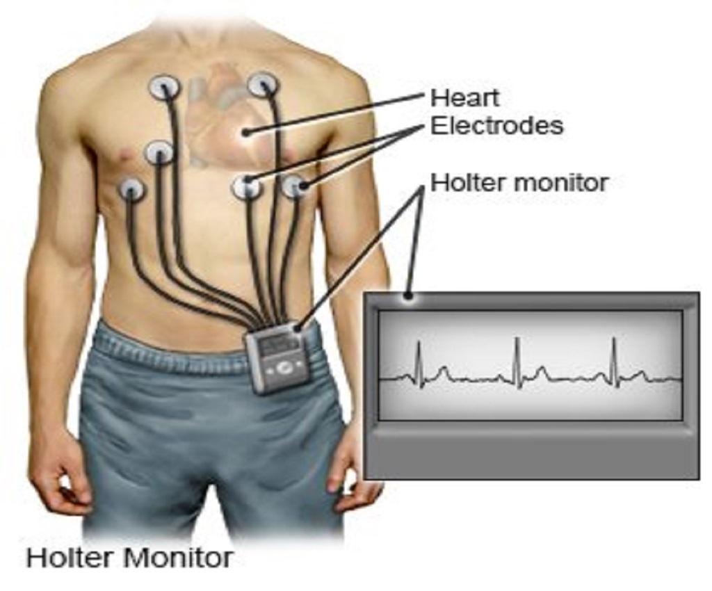 best holter moniter in  dindigul